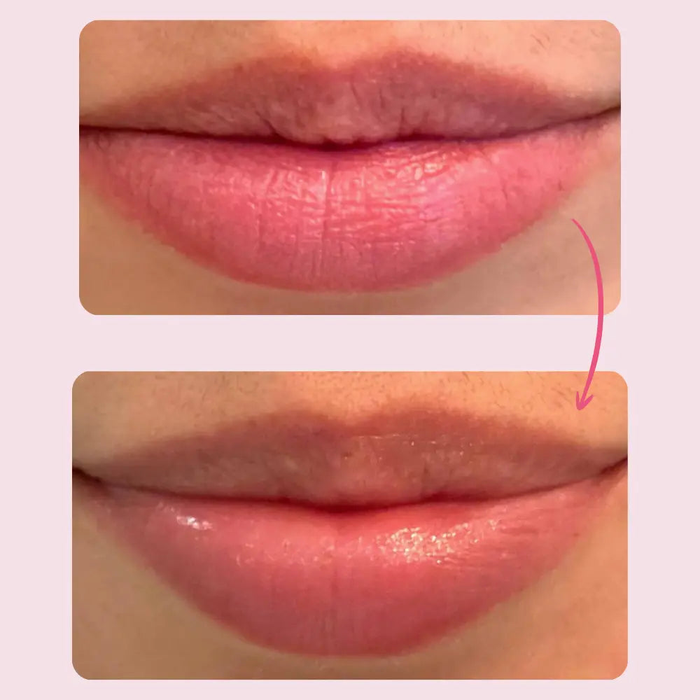 Bisou: Overnight Lip Infusion Tape